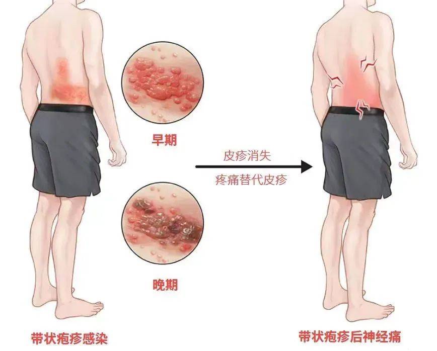一旦感染终身携带<strong></p>
<p>贵金属交易休市时间</strong>！深圳疾控提醒：这4类人要注意