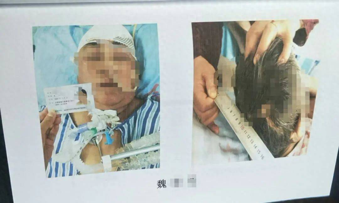 目睹母亲过马路被车撞<strong></p>
<p>国内正规的贵金属</strong>，27岁女子受惊吓5天后身亡