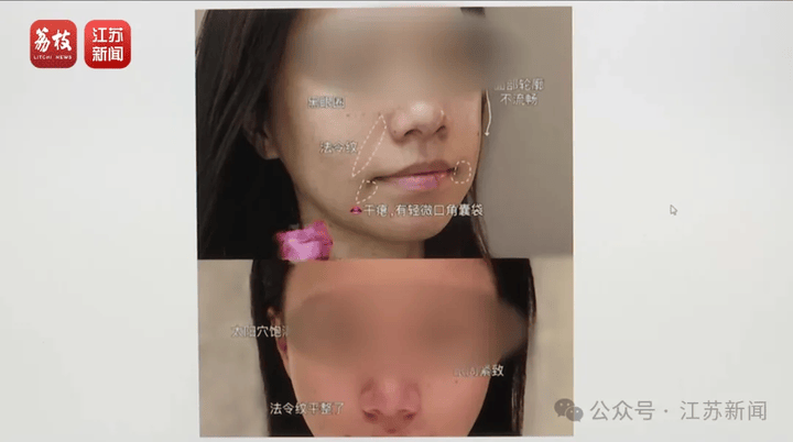 打一针“返老还童”的童颜针卖了30亿<strong></p>
<p>泰达币行情</strong>，真的有效吗？