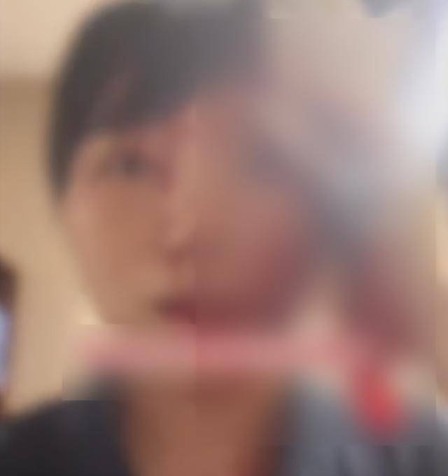 缝了20多针！女子称被不知名男同事砸头毁容<strong></p>
<p>OKEx价格</strong>，警方介入
