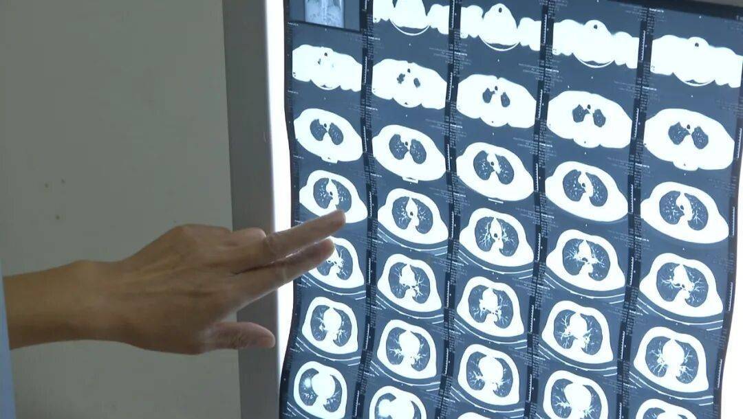 许多患者没有症状<strong></p>
<p>数字货币交易</strong>,发病就猝死!警惕这种心脏疾病