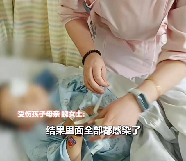 江西一5岁男孩在幼儿园被戳伤致左眼失明<strong></p>
<p>数字货币交易所投资</strong>，家长称老师用猪油涂抹试图消肿