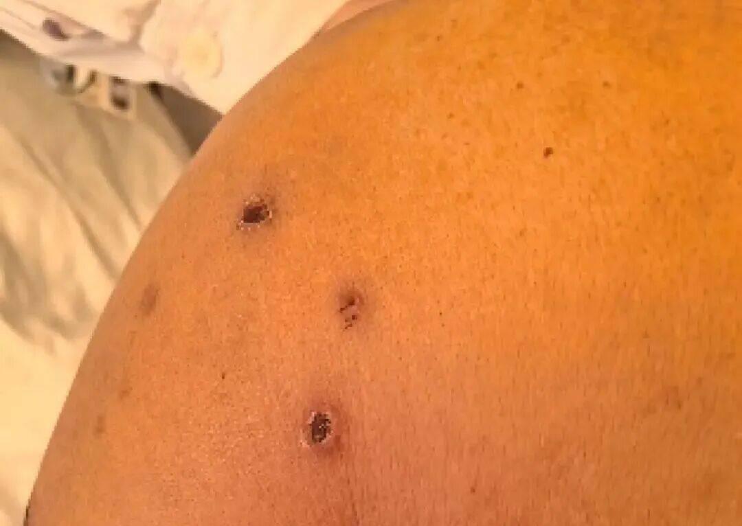 深圳一市民突遭马蜂围袭！已进入高发期<strong></p>
<p>数字货币交易APP下载</strong>，千万别招惹！