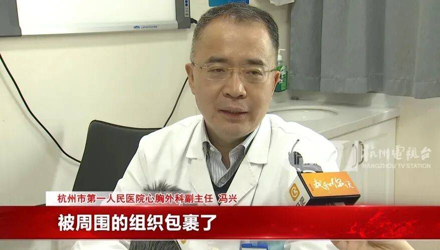 17岁小伙参军体检发现胸腔内有根5cm缝衣针<strong></p>
<p>平安证券交易行情</strong>，父母回忆或是1岁时扎入，取出时已锈迹斑斑